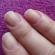 Verscheen longitudinale strepen op de nagels van de handen?
